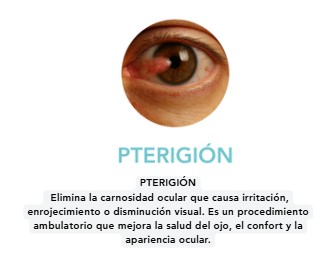 PTRIGION